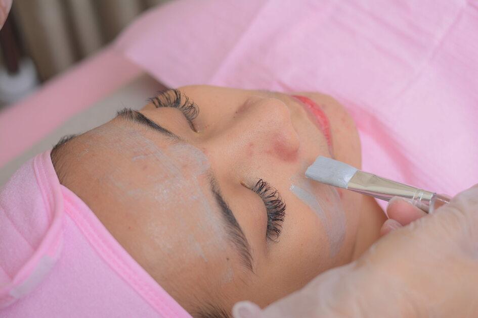 Acne Treatment Facial for Breakouts & Blemishes
