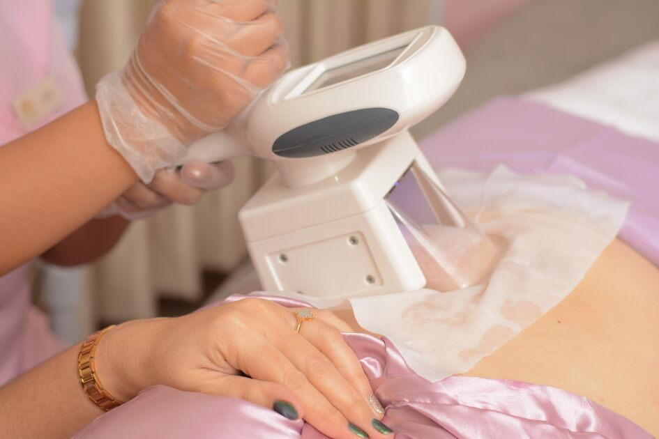 Cryolipolysis Fat Freezing for Tummy, Non-Surgical