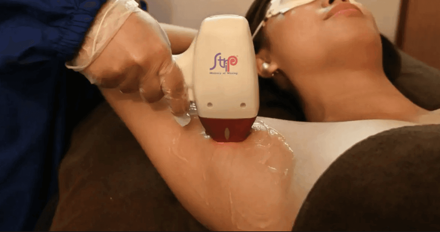 Strip Ice- Underarm