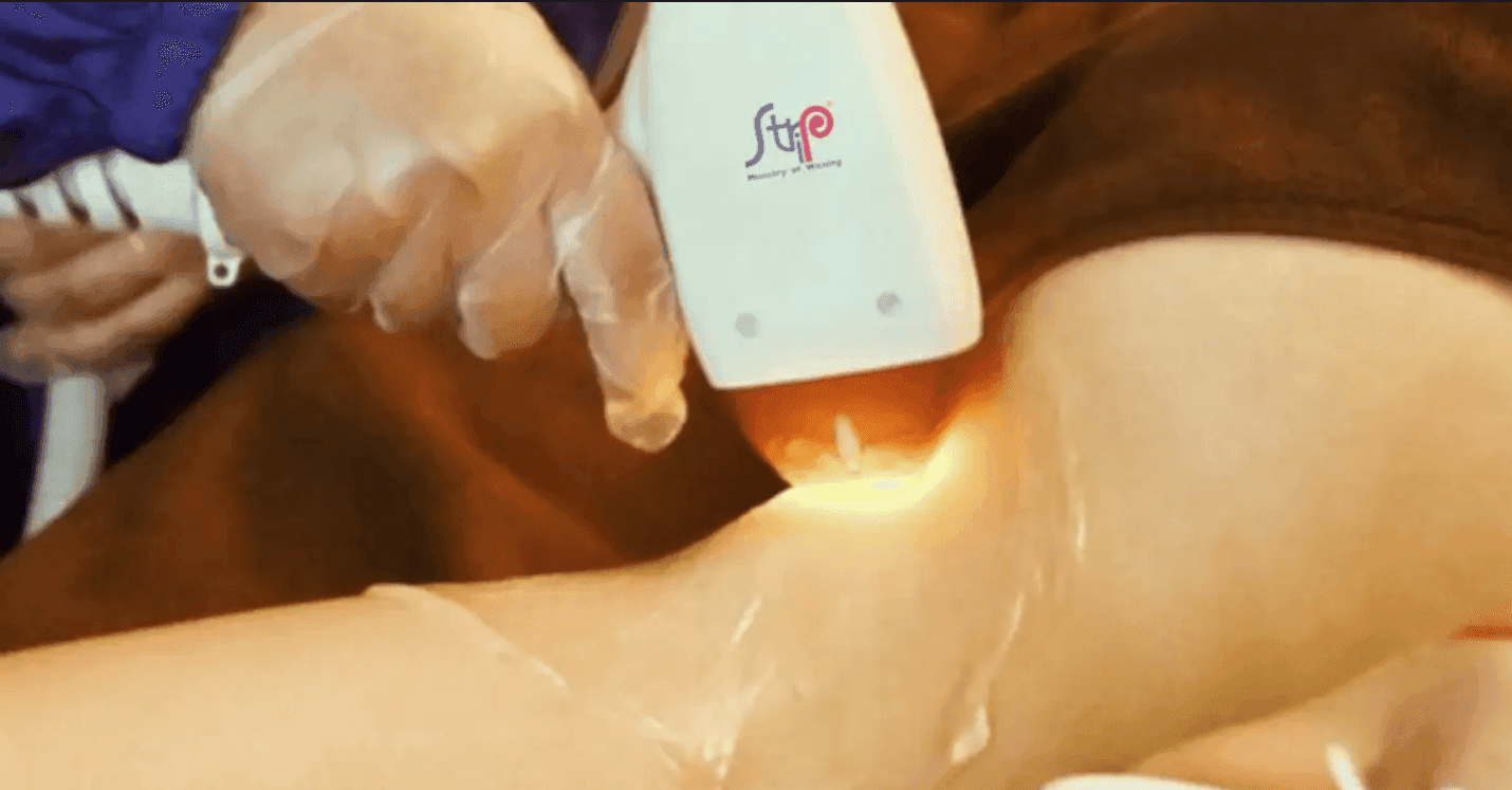 VBlush Underarm